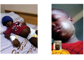 CSR Spotlight: Transforming Lives Through Compassion – Help Save Muhammad Ibrahim Yusuf