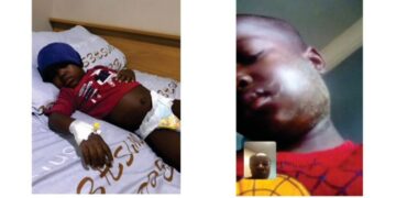 CSR Spotlight: Transforming Lives Through Compassion – Help Save Muhammad Ibrahim Yusuf